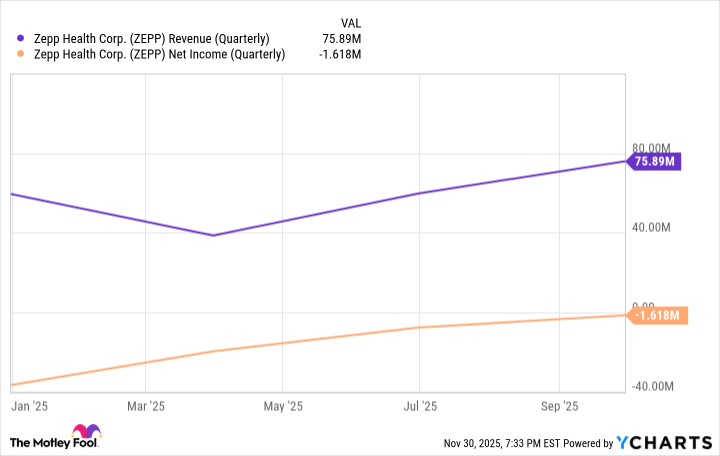 ZEPP Revenue (Quarterly) Chart