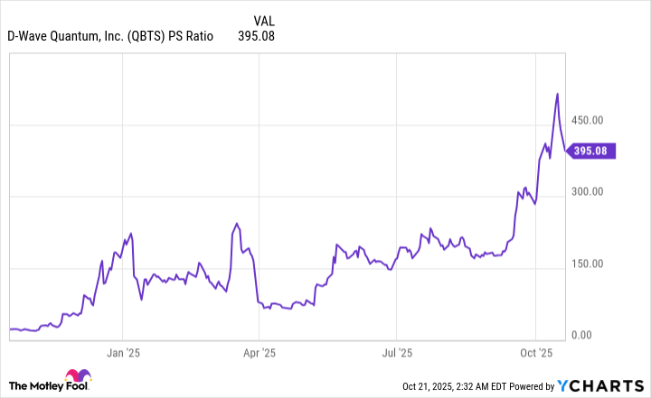 QBTS PS Ratio Chart